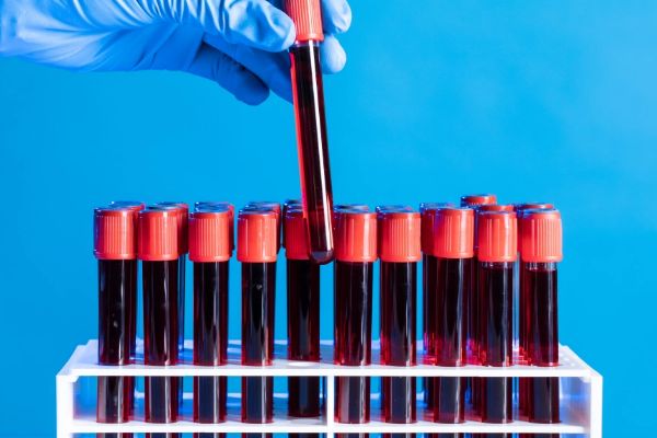从血型可以亲子鉴定吗？血型亲子鉴定可靠吗？