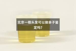 北京一根头发可以做亲子鉴定吗？